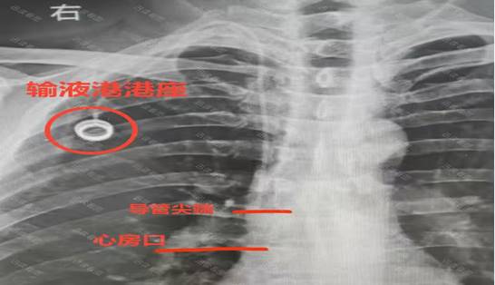 说明: dee0278bb7454d7e89a51295ce800719